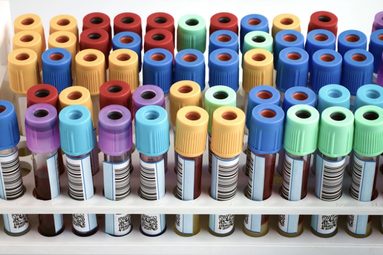 Clinical Sample